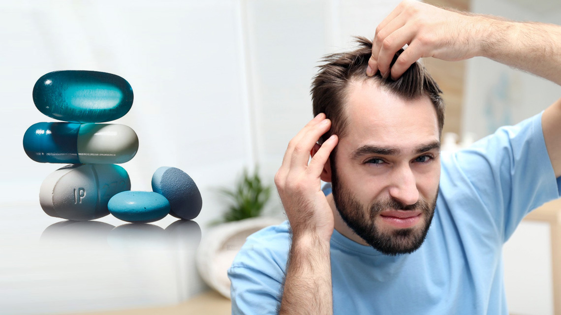 Common Generic Drugs for Hair Loss