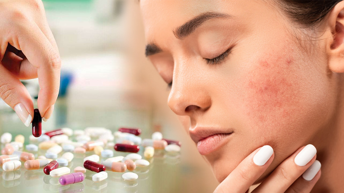 Skin Care: Generic Drugs for Acne
